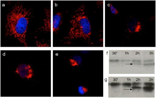 Cells treated with GA