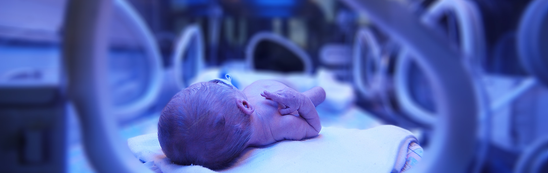 sick newborn baby in the neonatal intensive care unit