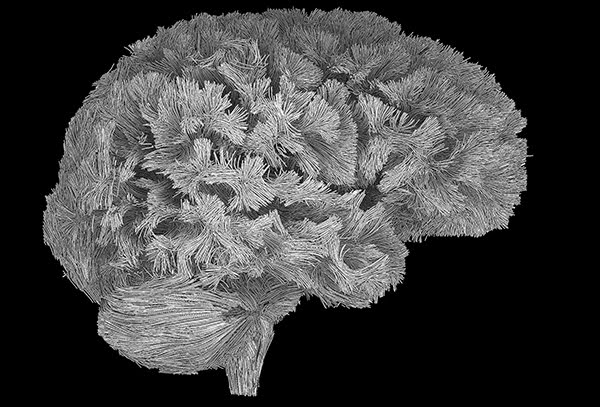 MR water diffusion in brain