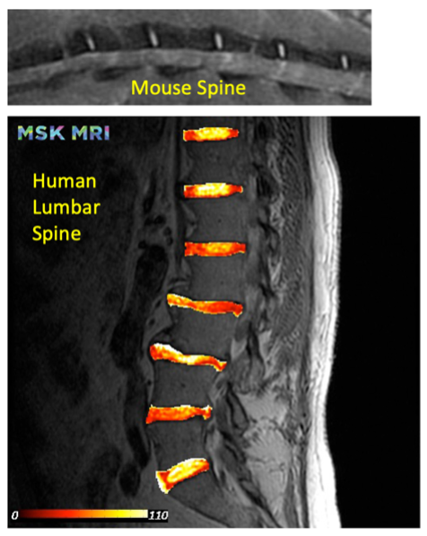 Mouse and Human Spine